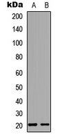 MED28 Rabbit Polyclonal Antibody