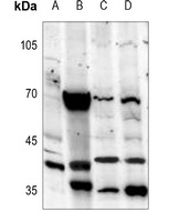 Melatonin Receptor 1a Rabbit Polyclonal Antibody