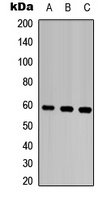 MMP28 Rabbit Polyclonal Antibody
