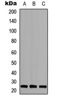 MOB3A/B Rabbit Polyclonal Antibody