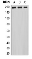MRCK alpha Rabbit Polyclonal Antibody