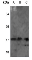 NDUFB7 Rabbit Polyclonal Antibody