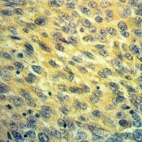 NDUFB7 Rabbit Polyclonal Antibody