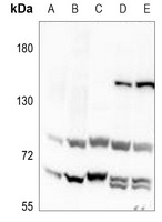 NOTCH4 Rabbit Polyclonal Antibody