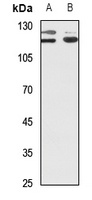 PPP1R13B Rabbit Polyclonal Antibody