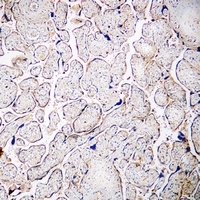 PSG3 Rabbit Polyclonal Antibody