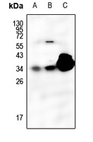 SFTPA1 Rabbit Polyclonal Antibody