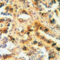 SFTPA1 Rabbit Polyclonal Antibody