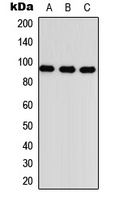 TGFBR3 Rabbit Polyclonal Antibody