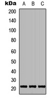 TGIF2LY Rabbit Polyclonal Antibody