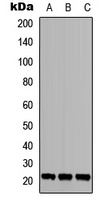 TGIF2LY Rabbit Polyclonal Antibody