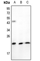 TNFAIP8L1 Rabbit Polyclonal Antibody