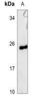UBE2E3 Rabbit Polyclonal Antibody