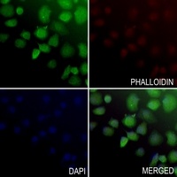UBE2E3 Rabbit Polyclonal Antibody