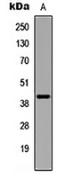 UBE2U Rabbit Polyclonal Antibody