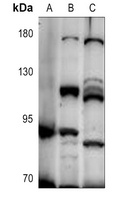 UNC5A Rabbit Polyclonal Antibody