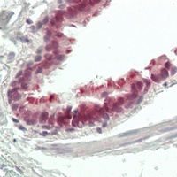 ZNF496 Rabbit Polyclonal Antibody