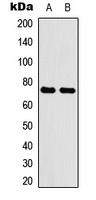 ABCG2 Rabbit Polyclonal Antibody
