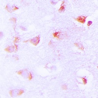 ACC alpha (Phospho-S80) Rabbit Polyclonal Antibody