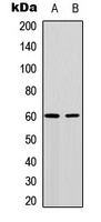 AKT Rabbit Polyclonal Antibody