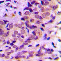 AKT Rabbit Polyclonal Antibody