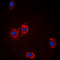 AKT Rabbit Polyclonal Antibody