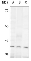 ALDOC Rabbit Polyclonal Antibody