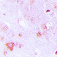 ALDOC Rabbit Polyclonal Antibody