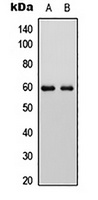 ALPP/ALPPL2 Rabbit Polyclonal Antibody (ALP)