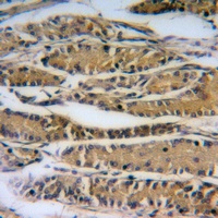 ALPP/ALPPL2 Rabbit Polyclonal Antibody (ALP)