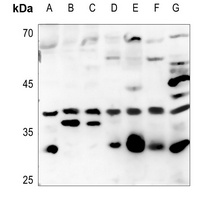 ATF5 Rabbit Polyclonal Antibody