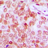 ATF5 Rabbit Polyclonal Antibody