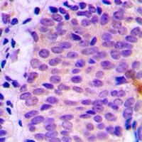 ATG4C Rabbit Polyclonal Antibody
