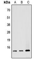 ATP5G1 Rabbit Polyclonal Antibody