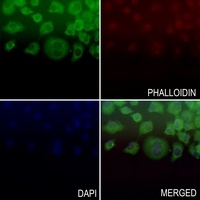 BAD (Phospho-S112) Rabbit Polyclonal Antibody
