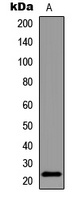 BAD (Phospho-S155) Rabbit Polyclonal Antibody
