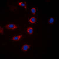 BAD (Phospho-S155) Rabbit Polyclonal Antibody