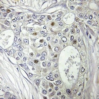 BATF Rabbit Polyclonal Antibody