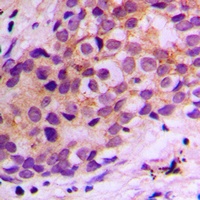 BAX Rabbit Polyclonal Antibody