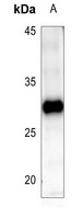 BCL2 Rabbit Polyclonal Antibody
