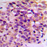BCL2 Rabbit Polyclonal Antibody