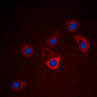 BCL2 Rabbit Polyclonal Antibody
