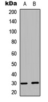 BCLX (Phospho-S62) Rabbit Polyclonal Antibody
