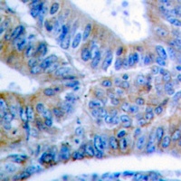 BCLX (Phospho-S62) Rabbit Polyclonal Antibody