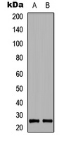 BIM (Phospho-S69) Rabbit Polyclonal Antibody