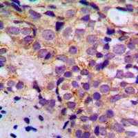 BIM (Phospho-S69) Rabbit Polyclonal Antibody