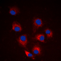 BIM (Phospho-S69) Rabbit Polyclonal Antibody