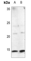 Procalcitonin Rabbit Polyclonal Antibody