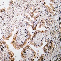Procalcitonin Rabbit Polyclonal Antibody