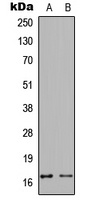 Calmodulin (Phospho-T80/S82) Rabbit Polyclonal Antibody